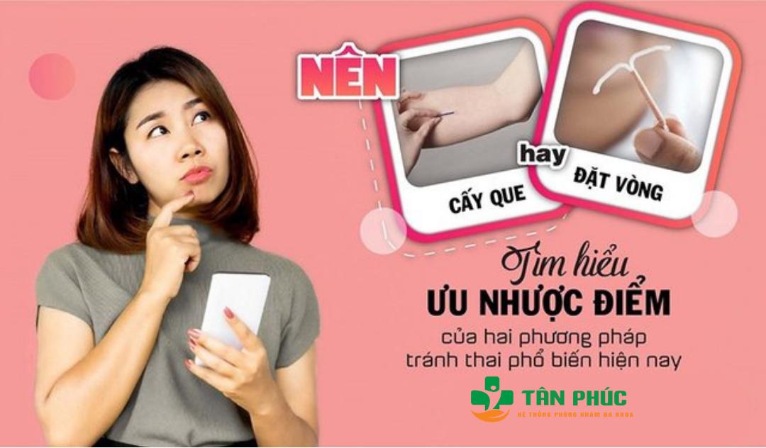 Nên tránh thai bằng đặt vòng hay cấy que?