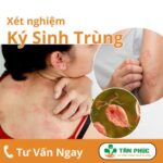 Nhiễm ký sinh trùng: Nguyên nhân, dấu hiệu, chẩn đoán và điều trị ký sinh trùng